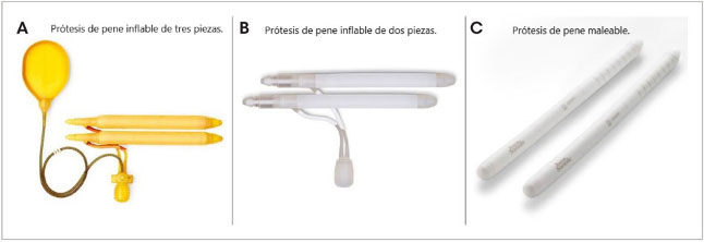Prótesis para el pene