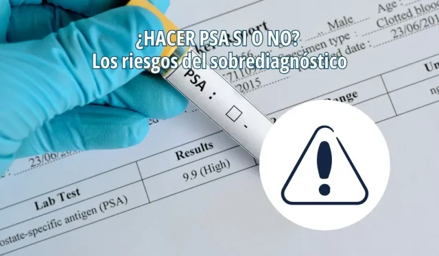 ¿Hacer análisis de PSA o no?
